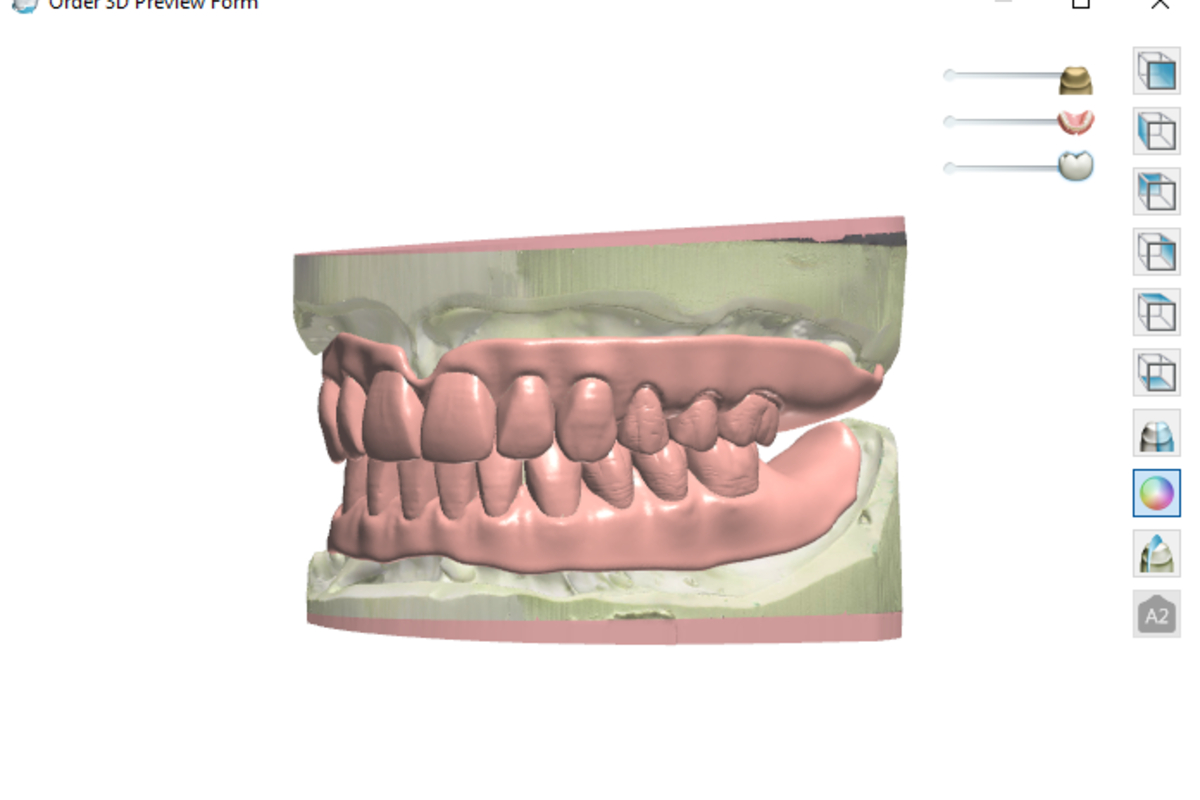 https://www.omnidental.com.au/wp-content/uploads/2020/10/Pre-op1200.jpg
